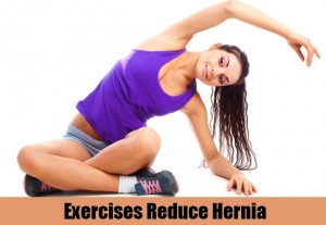 Helpful Exercises for Hernia Patients