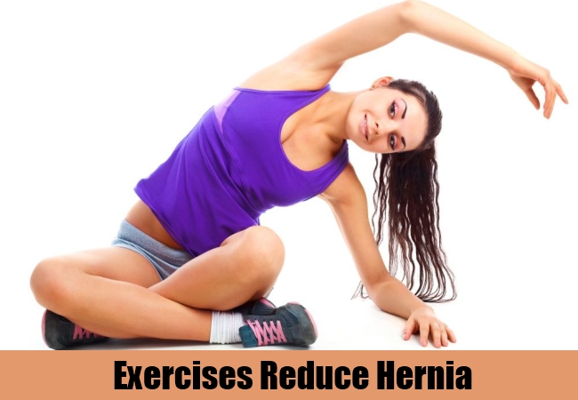 Helpful Exercises for Hernia Patients